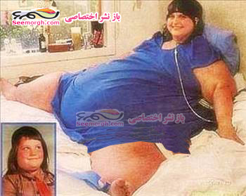 چاق ترین زن در کل تاریخ جهان؛ ۷۲۷ کیلوگرم!! + عکس  