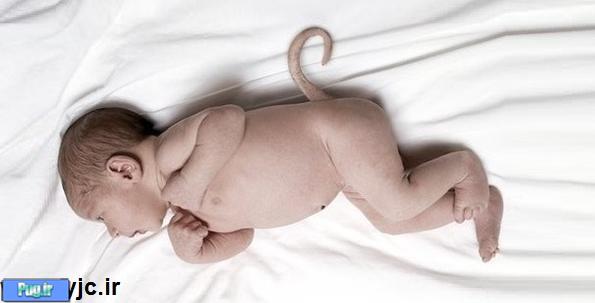 به دنیا آمدن نوزاد دم دار و کودکی با دو صورت! + تصاویر