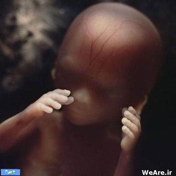 تصاویر: از ابتدای لقاح تا تولد نوزاد انسان!!