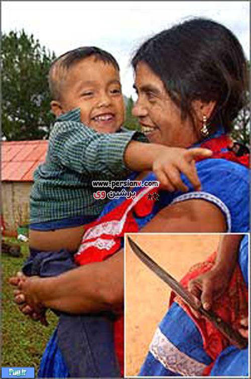 عکس:زنی که هنگام وضع حمل خودش را سزارین کرد