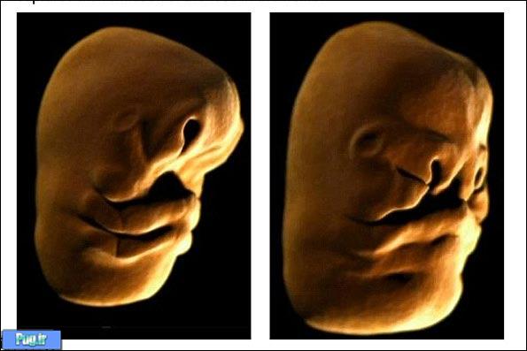 اولین انیمیشن از نحوه تکامل صورت در جنین+تصاویر 