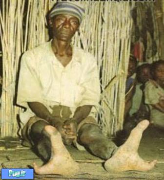 پاهای عجیب یک قبیله در افریقا / تصاویر