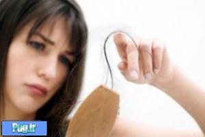 آیا کاشت مو برای خانم ها هم ممکن است؟ (2)  